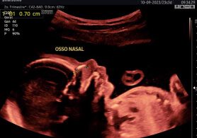 Obstetrico 1 Obstetrico 1